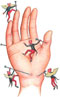Joint Pain